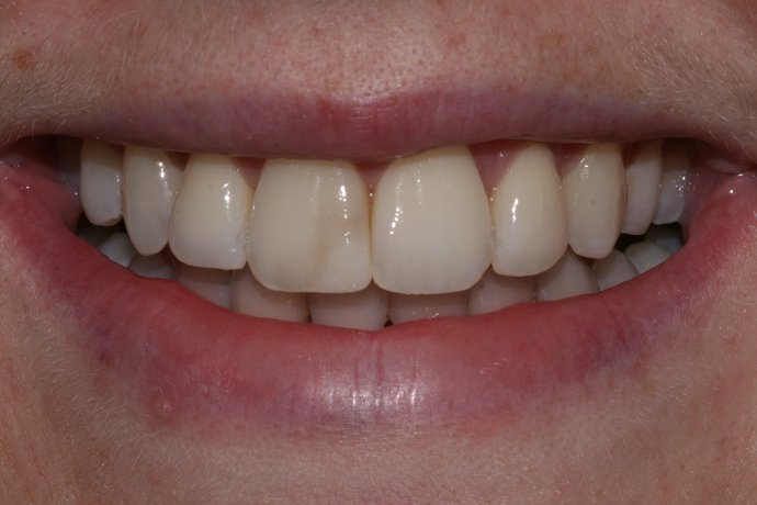 image of bioclear case study