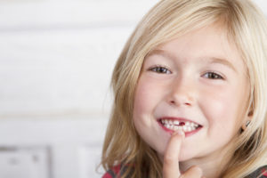 image of child with lost tooth