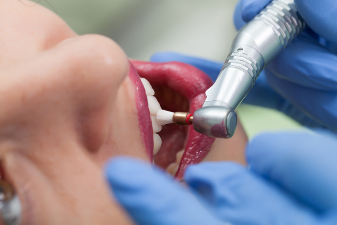 image of dental therapist in action