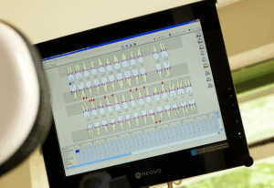 image of teeth on screen