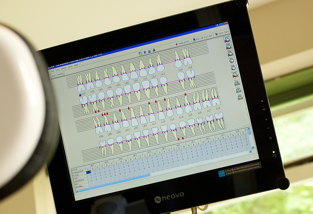 Root canal treatment starts with an X-ray of the problem tooth. image of teeth on screen
